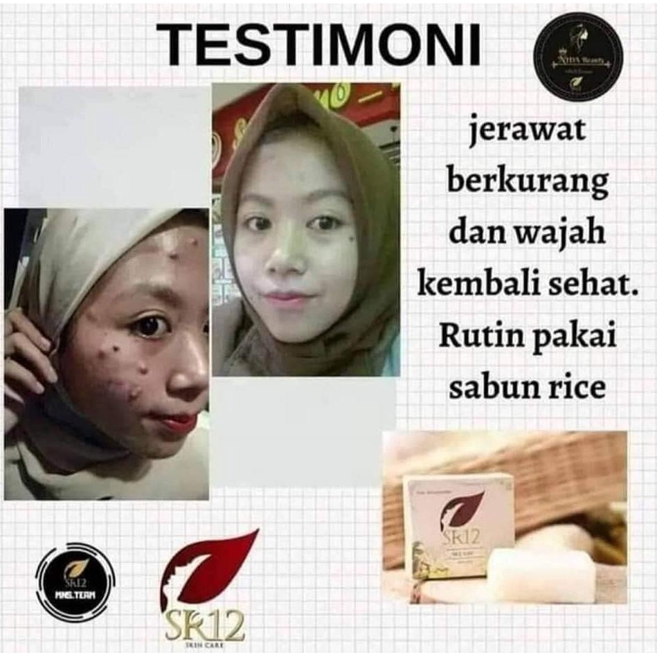 Sabun Beras SR12 Rice Soap Sabun Pembersih Wajah Pria Berjerawat Pemutih Pencerah Kulit Wajah Dan Badan SR12 BPOM Ori S94e