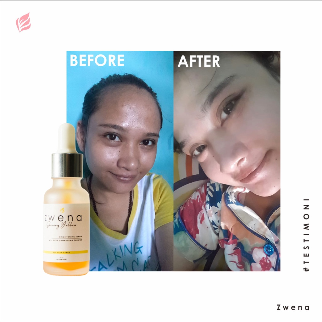 Zwena Brightening Serum Perawatan Kecantikan Wajah, Flek Hitam dan Kerutan Essence Brightening Niacinamide Original BPOM