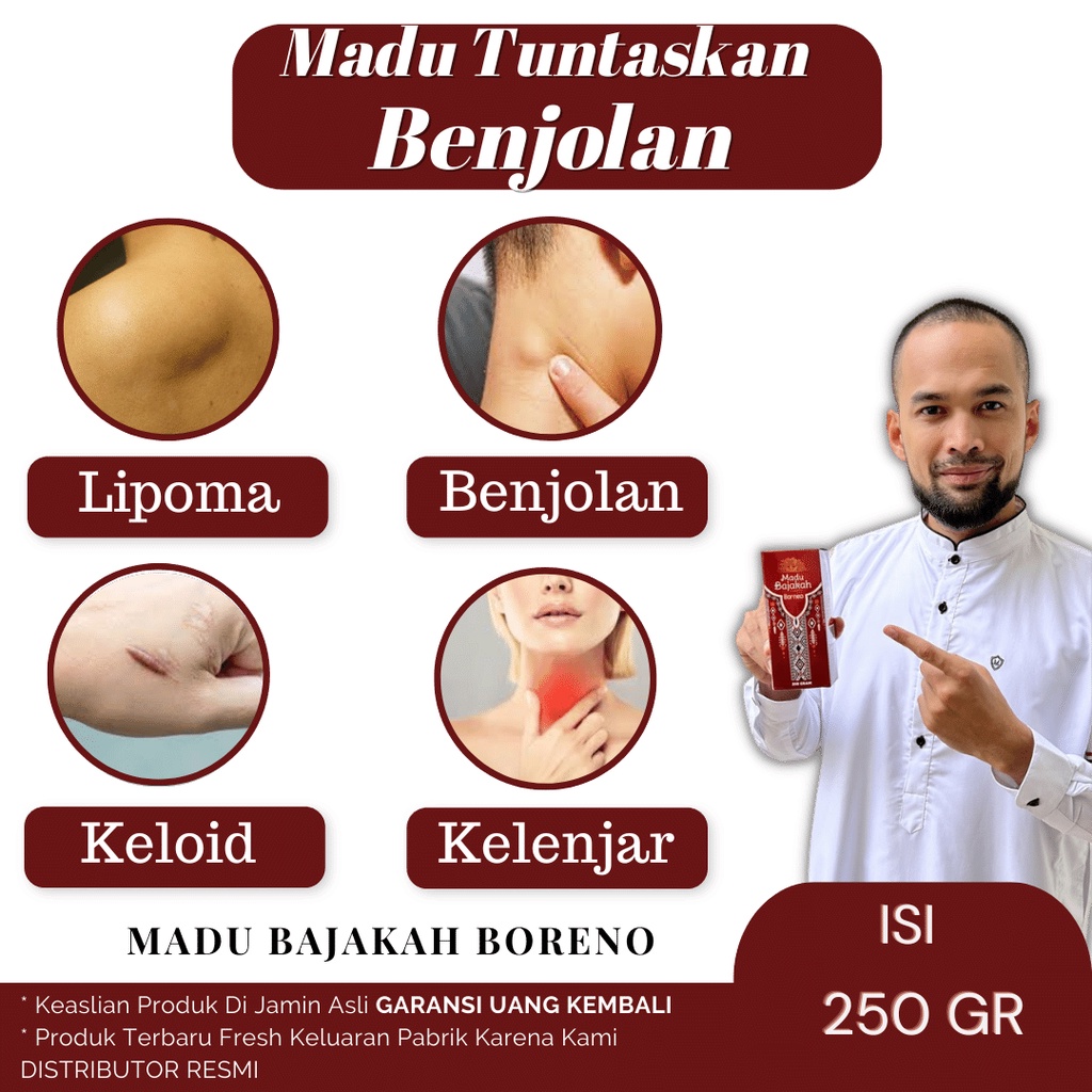 

Madu Bajakah Borneo PREMIUM - Benjolan, lipoma, kelenjar, getah bening, keloid, kanker , tumor. tiroid, miom, dan Gondok