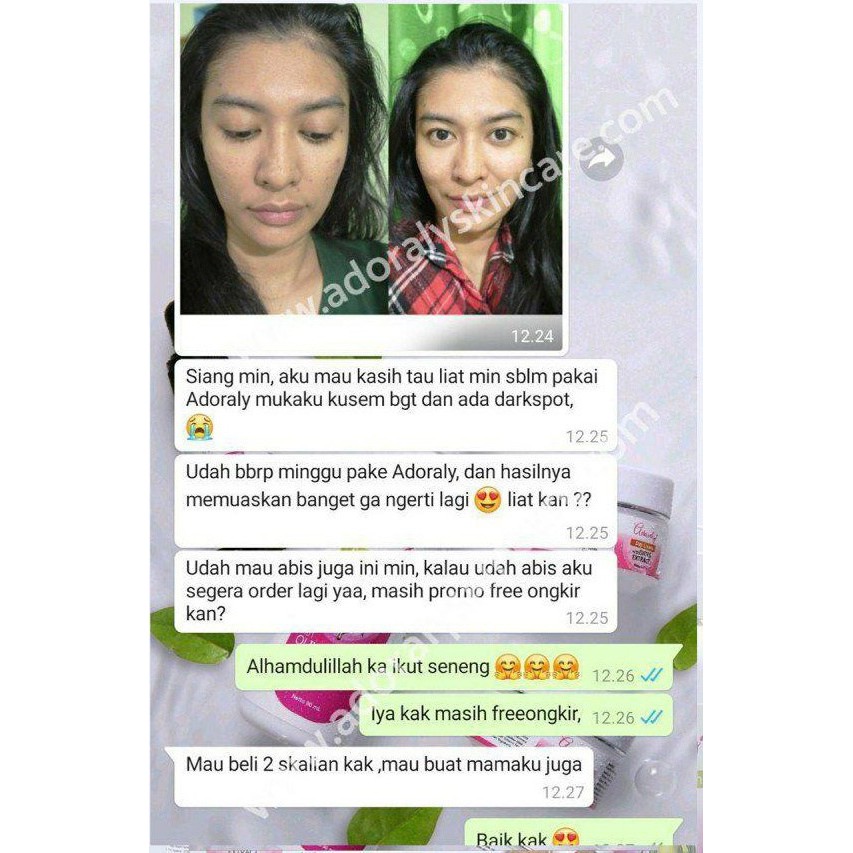 [1 PAKET] ADORALY (Bonus TUMBLER dan POUCH) -SKINCARE BPOM, GLOWING, ANTI JERAWAT, FLEX HITAM, KUSAM-7