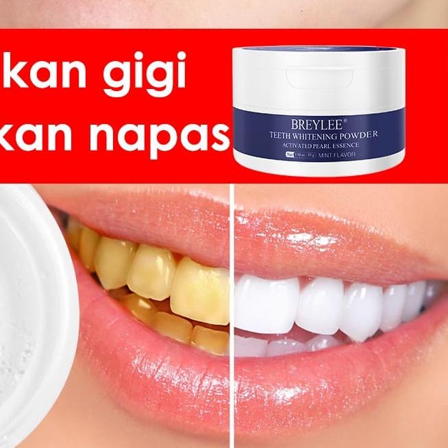 .⭐️⭐️BIG SALE⭐️ ⭐️(BISA &LANGSUNG KIRIM) Pemutih Gigi Kuning Kerak Penghilang Karang Permanen Origin