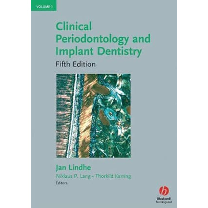 CD Clinical Periodontology and Implant Dentistry Diskon