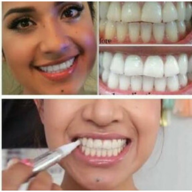 Pemutih Gigi instan / Pen whitening