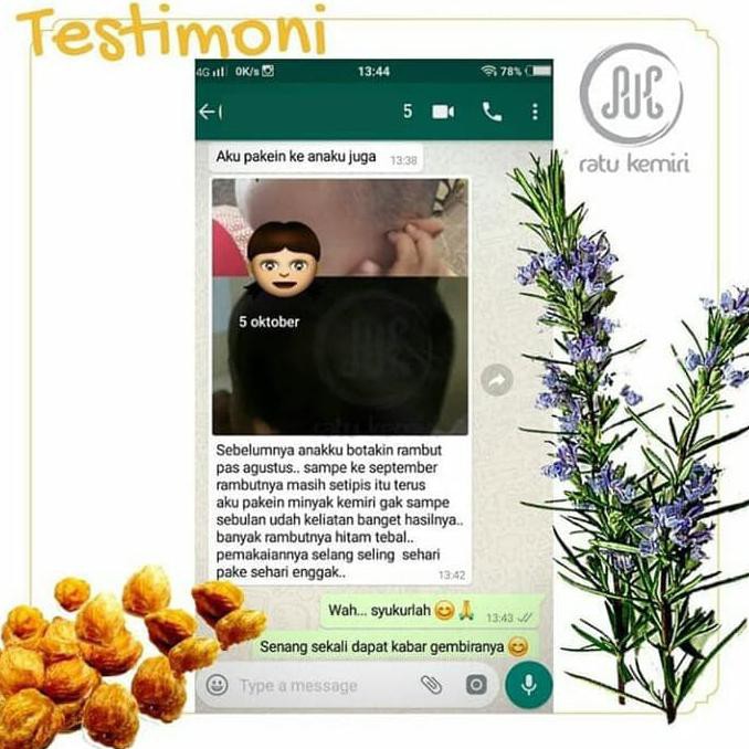 476G84Y7-Terlaris-Sale-- Minyak Kemiri Penumbuh Rambut Bayi Dan Anak - Ratu Kemiri - Ukuran 100Ml