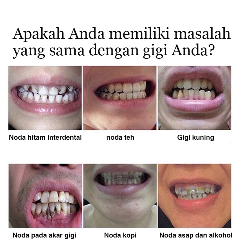 Pemutih Gigi Dan Penghilang Karang Gigi 100% MANJUR TERBUKTI 30ML Teeth Whitening Ori dan Bpom