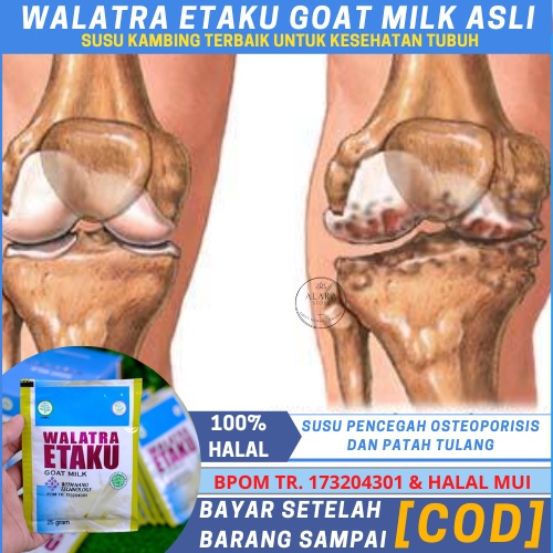

Susu Kambing Etawa Bubuk Untuk Susu Pencegah Tulang Keropos Dan Patah Tulang
