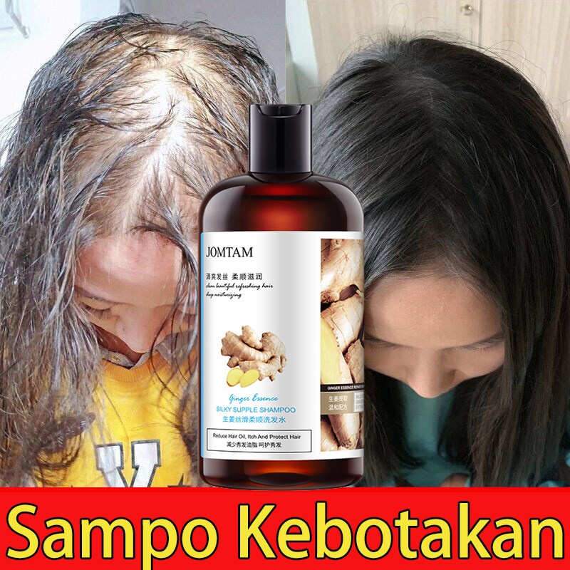 [100% asli] Shampo Penumbuh Rambut Cepat Serum Rambut Rontok Botak Rontok Penumbuh Rambut Perawatan Hair Care Treatment Anti Rambut Rontok