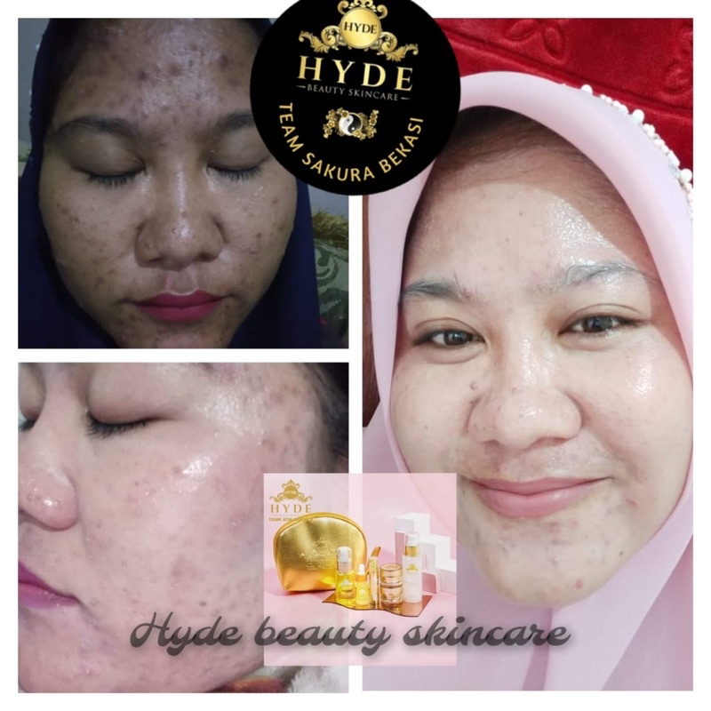 Serum Glowing Extra lemon Hyde Beauty Skincare