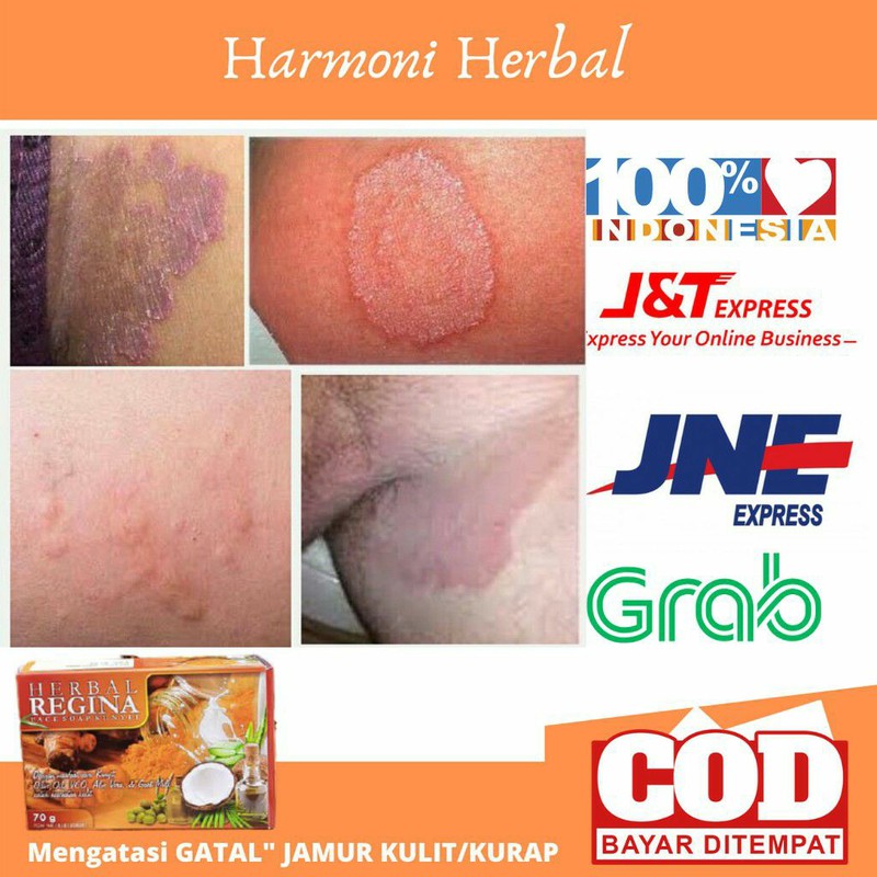 Sabun Herbal Regina Obat Gatal Jamur Kulit Kadas Kurap Jerawat Di Punggung Gatal Selangkangan Shopee Indonesia