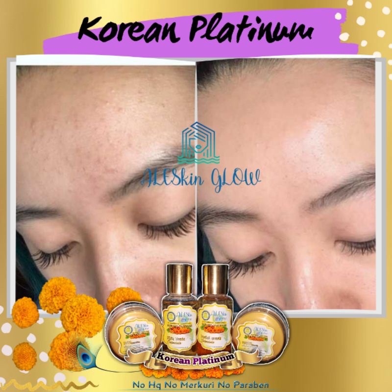 KOREAN PLATINUM ALESKIN GLOW Skincare Glowing-Paket Perawatan Wajah Korea-Cream Glowing-Cream Pemutih Wajah