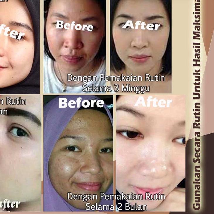 ✞PROMO✞ Krim Cream Pemutih Wajah Flek Noda Hitam Anti Aging Penuaan Dini Whitening Brightening Essen