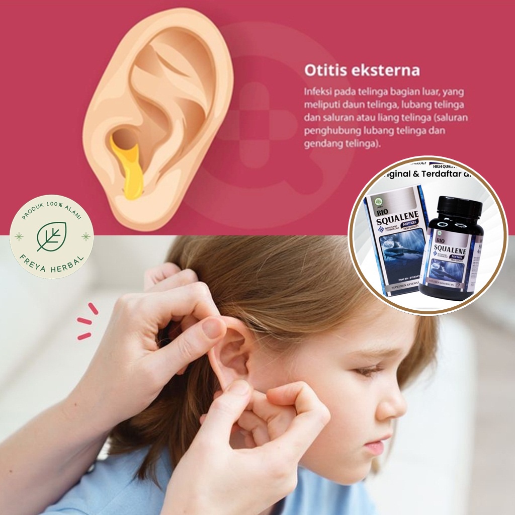 OBAT TELINGA BERNANAH, OBAT OTITIS EKSTERNA, OBAT TELINGA BERAIR, OBAT CONGEK