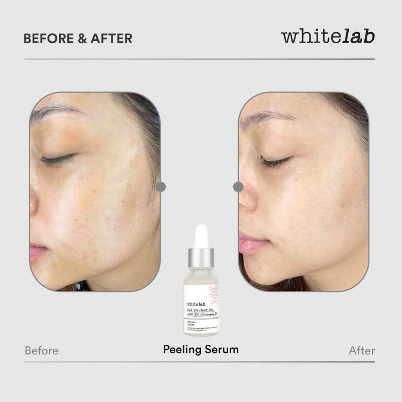 WHITELAB PEELING SERUM AHA 5%+BHA 2%+PHA 2% + Niacinamide 2%