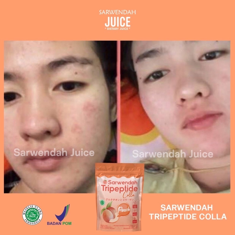 TRIPEPTIDE COLLA PEACH POUCH / COLLAGEN PEACH MENCERAHKAN BADAN WAJAH / MEMUDARKAN BEKAS LUKA SECARA ALAMI / ANTI AGING / WHITENING BOOSTER COLLAGEN