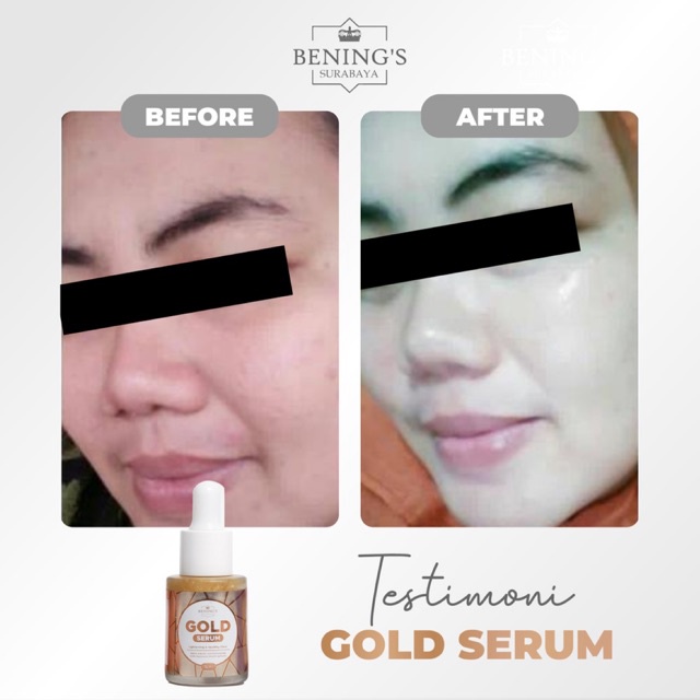 BENING'S SERUM GOLD | MENCERAHKAN, MELEMBABKAN &amp; MERATAKAN WARNA KULIT I FREE GIFT SIAP KIRIM KE SELURUH INDONESIA