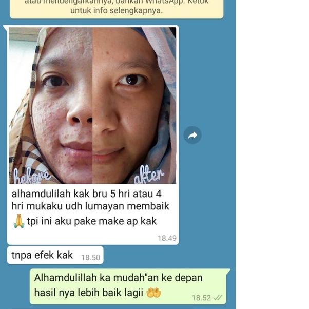 ✬ ADERA FACE SERUM ORIGINAL SERUM ADERA WAJAH ORI UNTUK FLEK HITAM GLOWING ORI ASLI 100% ۩