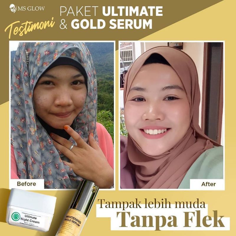 WHITENING GOLD SERUM MSGLOW, SERUM FLEK NODA HITAM SERUM SULTAN ANTI AGING