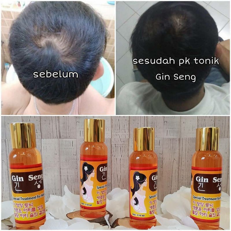 Hair Tonic Red Ginseng Korea Penumbuh Rambut