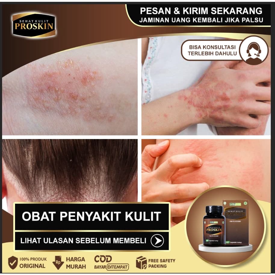 Jual Obat Scabies Kurap Panu Kudis Psoriasis Vitiligo Proskin Obat