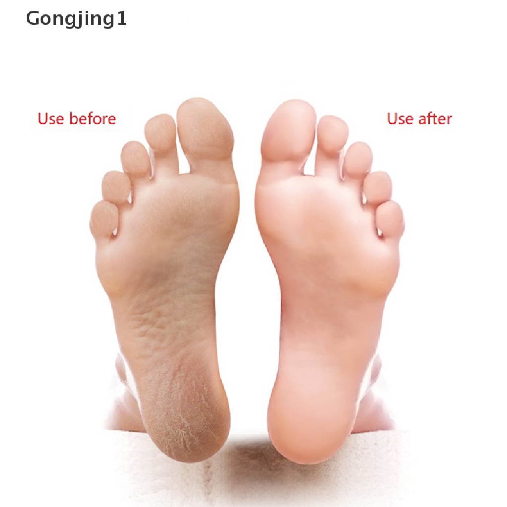 Gongjing1 10 In 1 Alat Kikir Kaki Bahan Stainless Steel Untuk Pedicure