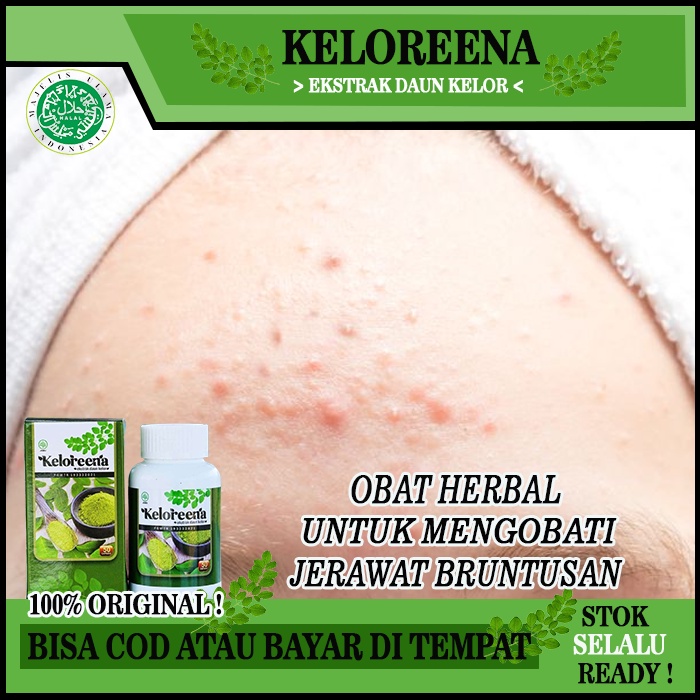 Obat Untuk Masker Wajah Organik Penghilang Jerawat Beruntusan, Obat Beruntusan Wajah, Obat Penghilan