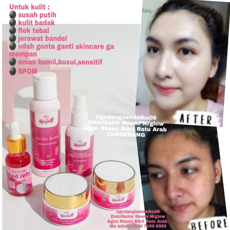 PAKET SKINCARE PEMUTIH WAJAH - CREAM BPOM NR GLOW RJN SKINCARE CEPAT PUTIH,GLOWING