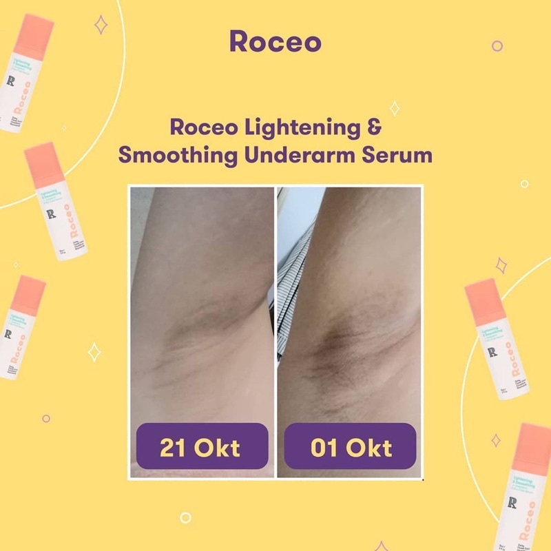 ROCEO lightening &amp; smoothing underarm serum ketiak cerah