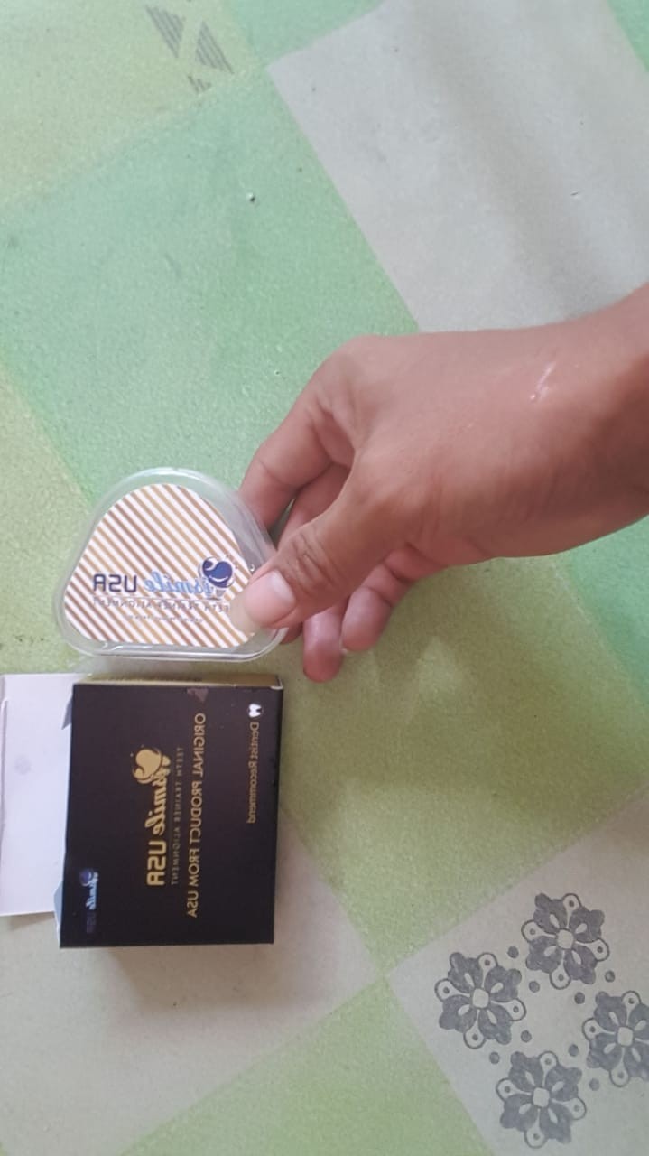 Ismileusa Perapih Gigi Transparan / Biru