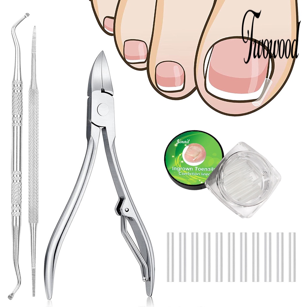 Twowood 1 Set Alat Perawatan Kuku Kaki Ingrown Bahan Stainless Steel Adjustable