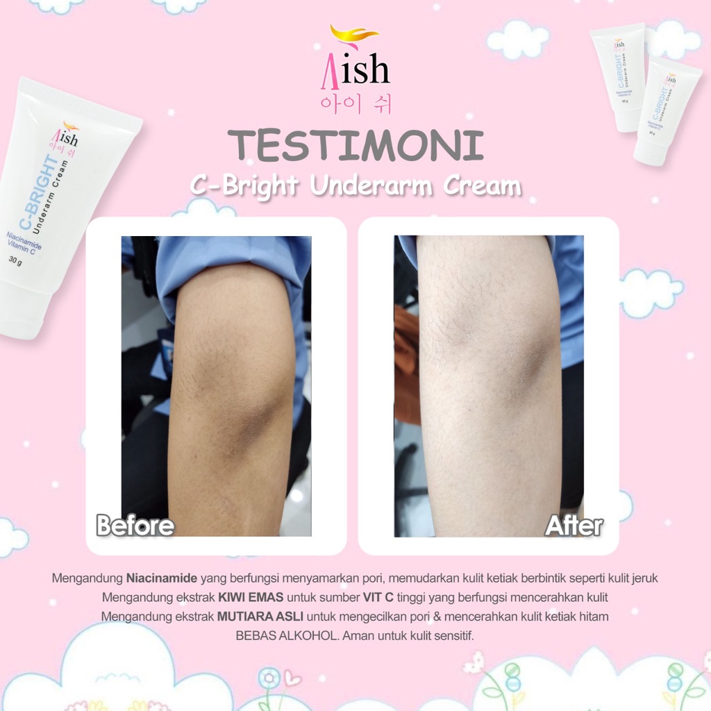 AISH KRIM KETIAK / AISH KRIM SELAKANGAN / BISA COD! AISH UNDERARM CREAM / AISH C BRIGHT AISH C BRIGHT UNDERARM CREAM / AISH UNDERARM KOREA / AISH NECK SERUM / C BRIGHT KETIAK ORIGINAL ORI 100%