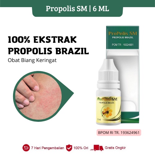Propolis SM - Obat Biang Keringat Anak, Bruntusan Gatal Biduran Menahun Salep Gatal Gatal Kulit Obat