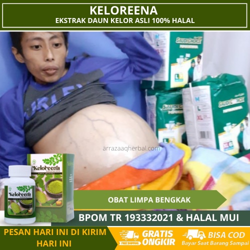 KELOREENA - Obat Limpa Bengkak, Limpah Bengkak, Limpa Membengkak, Pembengkakan Limpa, Pembesaran Lim