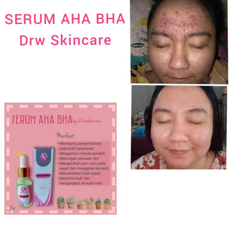 Drw Skincare Serum AHA BHA Jerawat