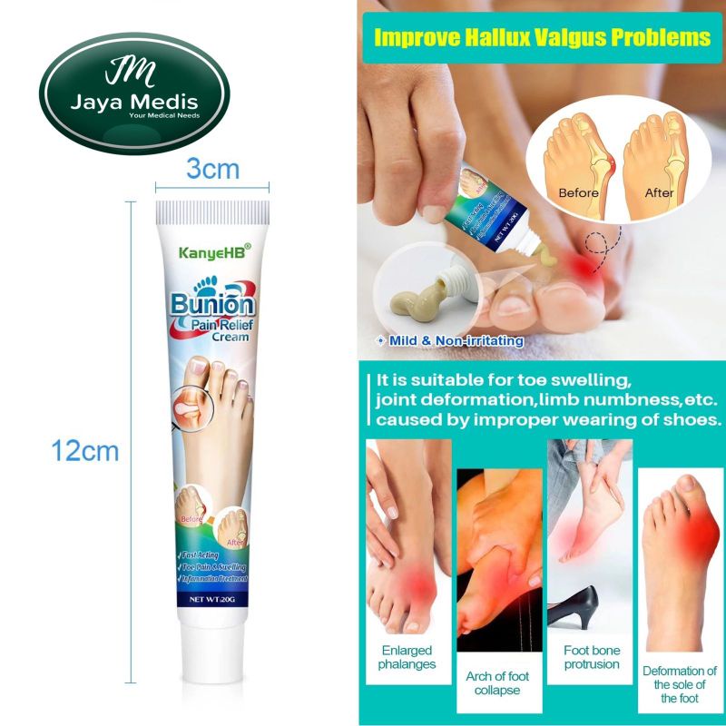 Cream Nyeri Sendi Valgus Arthritis - Bunion Pain Relief Cream 20g