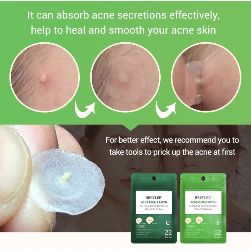 Breylee Acne Pimple Patch