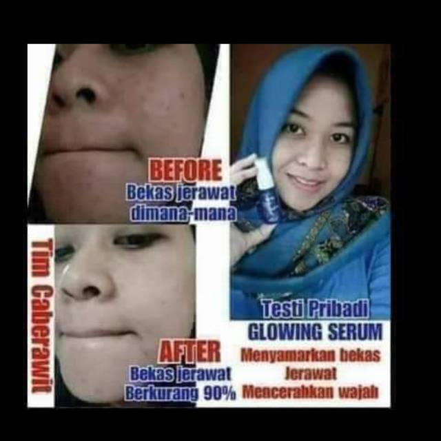 #SerumGlowingMsi