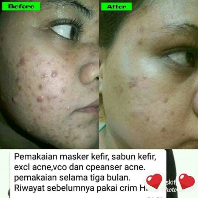 Cream Exclusive Oily Batrisyia eksklusif oil Pelembab Wajah untuk kulit berminyak kusam berjerawat