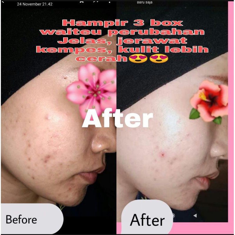 PAKET 4 Box laili waiteu collagen waiteu kolagen