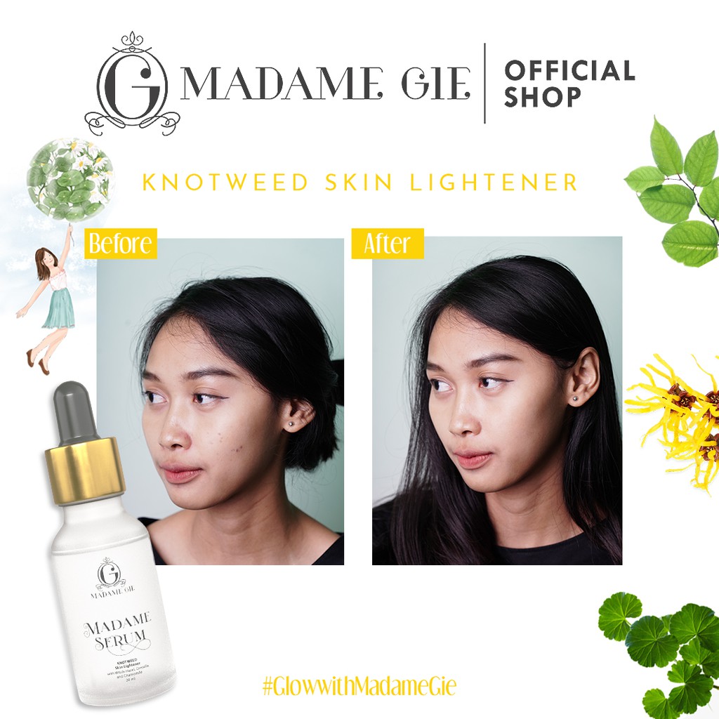 Madame Gie Madame Serum - Skin Care Face Serum-5