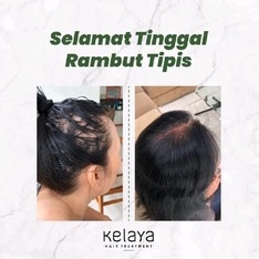 KELAYA SHAMPOO + MINYAK KEMIRI + SERUM HAIR TREATMENT