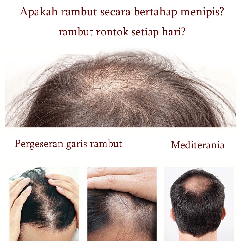 Shampo penumbuh rambut Anti ketombe Sampo anti rambut rontok 400ml Mempercepat pertumbuhan rambut Kontrol minyak yang menyegarkan Anti gatal dan anti ketombe Pelembab ringan Perawatan rambut bergizi