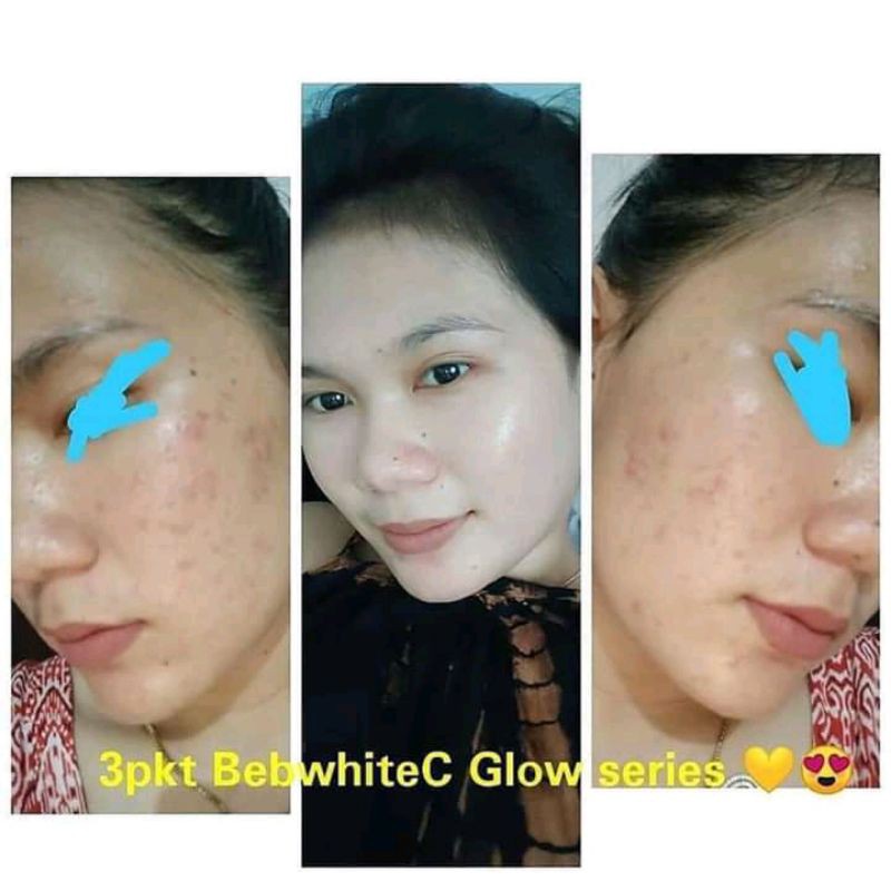 perawatan kecantikan wajah