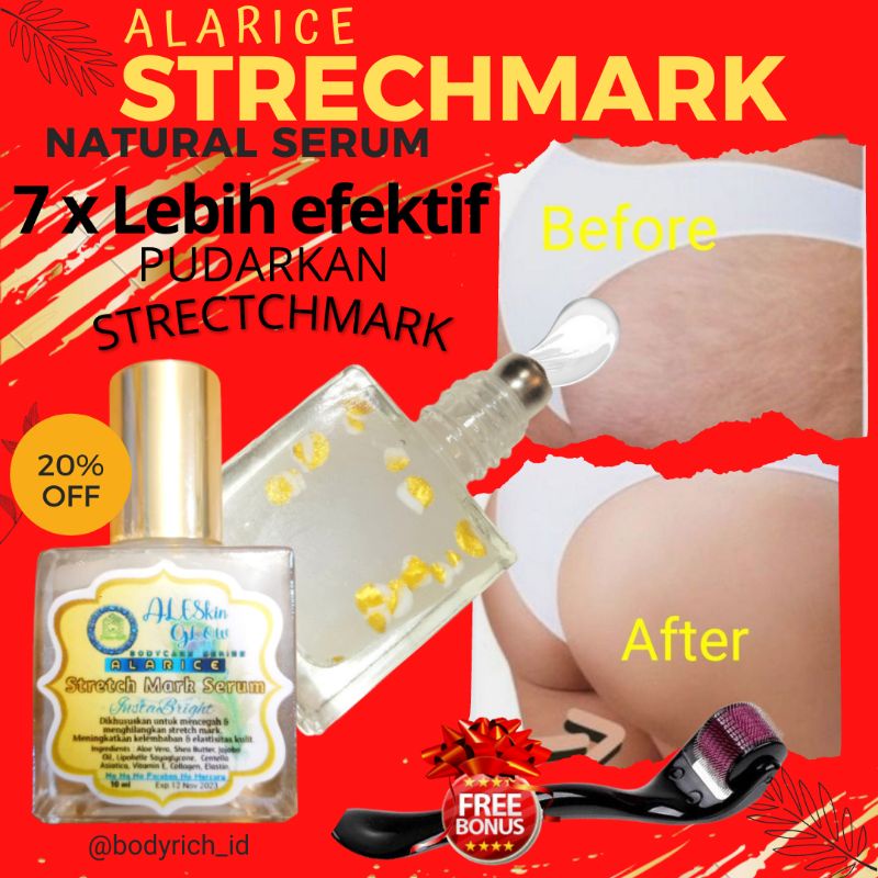 SALE PROMO !! ALARICE STRECHMARK CREAM PENGHILANG STRETCH MARK PALING AMPUH PERMANEN UNTUK IBU HAMIL