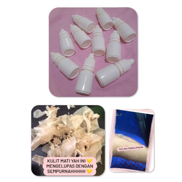Peeling Pengelupasan Badan (10ml)