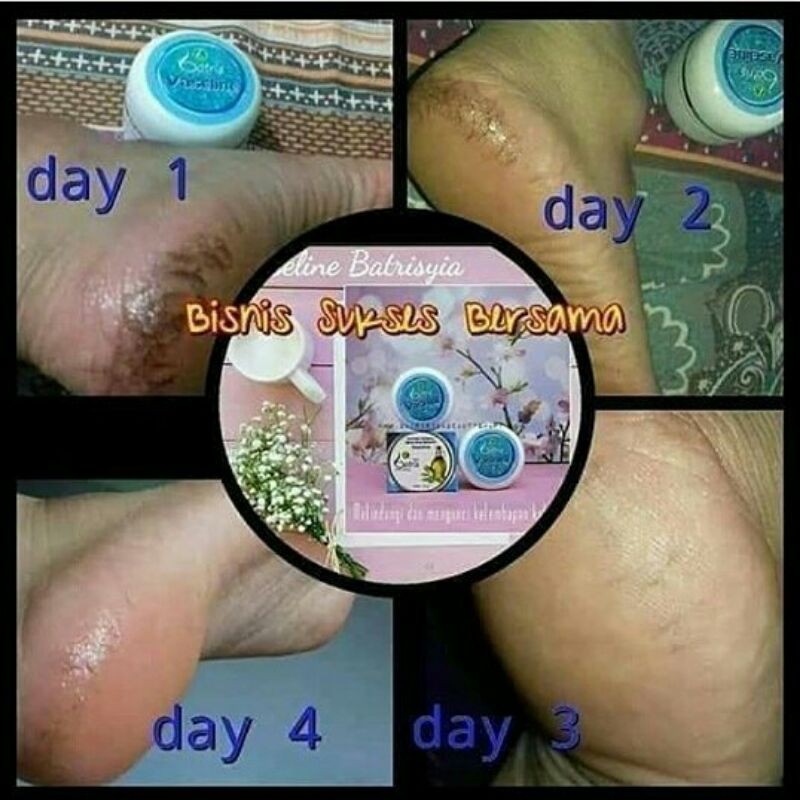 Vaselin batrisyia herbal pelembab protaleum jelly cream atasi kaki kering pecah pecah