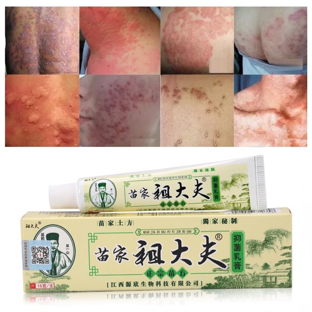 Salep Zudaifu Psoriasis Dermatitis Eksim Salep Anti bakteri Anti Gatal Krim Kulit