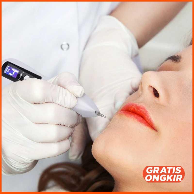 Pen Laser Plasma Penghilang Jerawat Dark Spot Wajah JT75