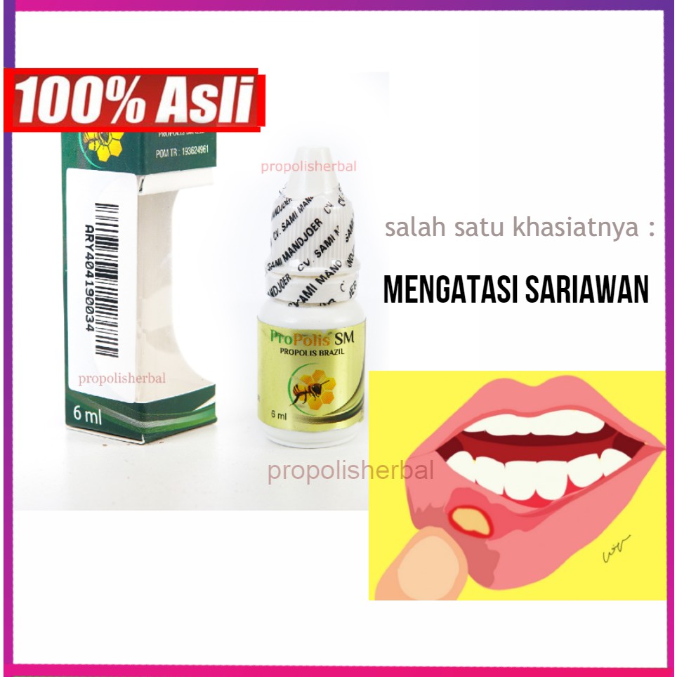 Obat Sariawan Kronis Lama Sembuh Dengan Herbal Propolis Sm Shopee Indonesia