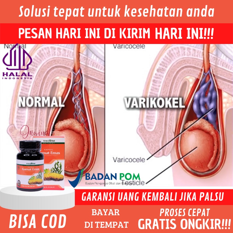 Obat Varikokel Testis Bengkak, Penghilang Sakit Di Buah Zakar , Obat Hidrokel Alami, Hernia Turun Be
