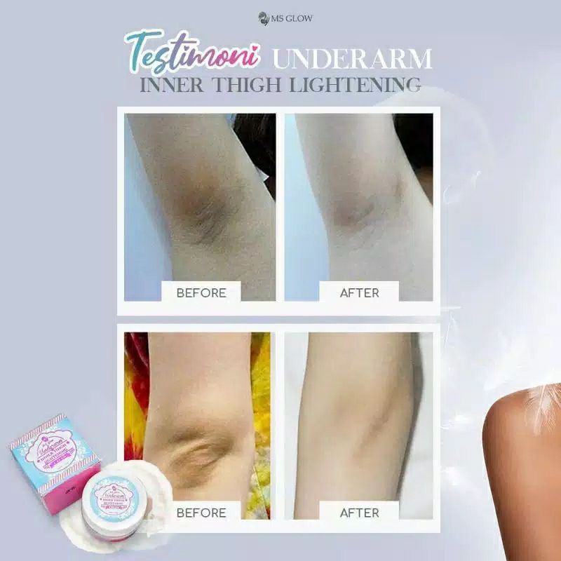 UNDERARM CREAM ORIGINAL by MS GLOW